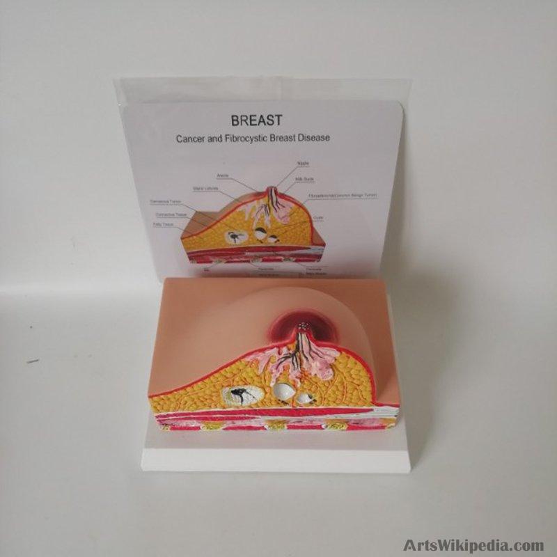 Breast Pathology Anatomy Model Kit