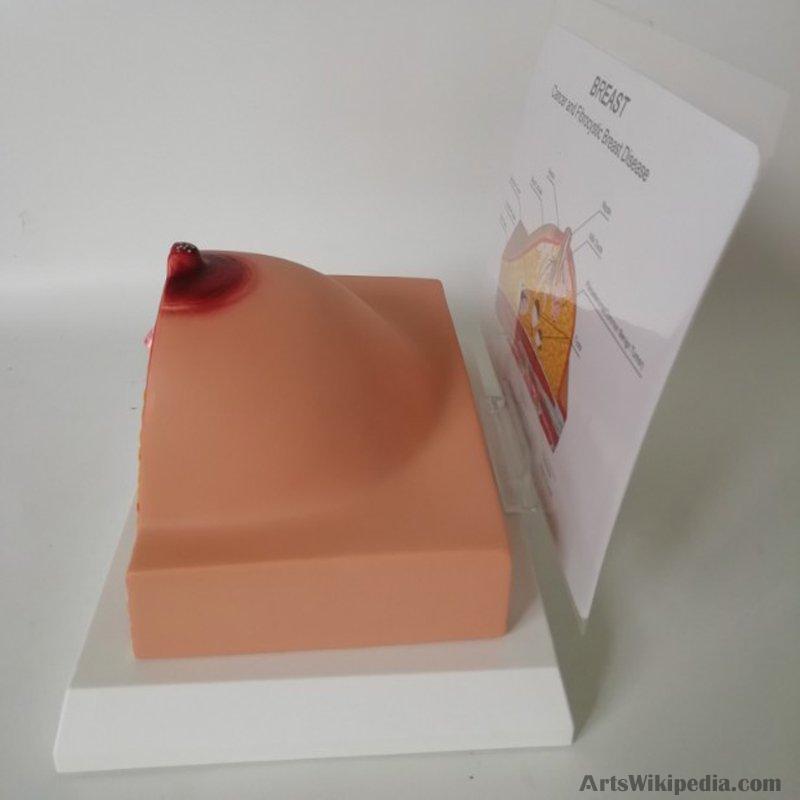 Breast Pathology Anatomy Model Kit