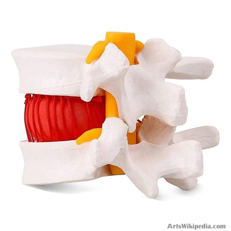 Human Osteoporosis Model Demonstration Model of Intervertebral Disc ...